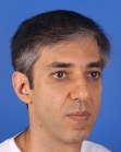 After Hair Transplant&nbsp;2 Sessions (Areas)